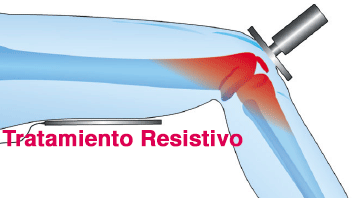 Pilates Valladolid - Diatermia - tcare Pilates Valladolid - Diatermia - tcare